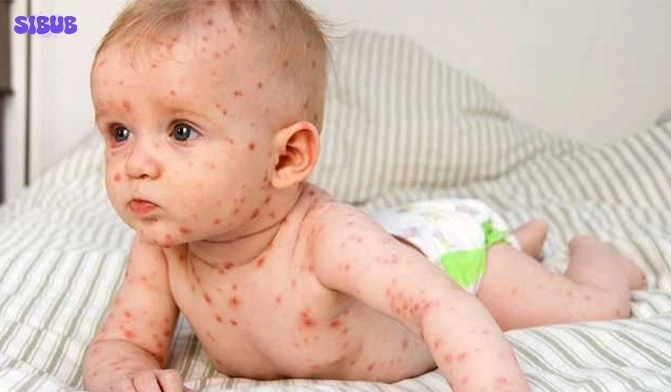 When to Worry About Rash on Child